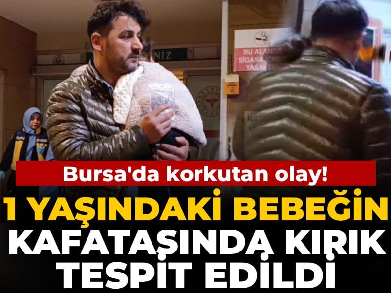 1 Yaşındaki Bebeğin Kafatasında Kırık Bulundu