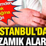 istanbulda-kizamik-alarmi-chpli-isimden-saglik-bakanligina-cagri-IdP2NmOx